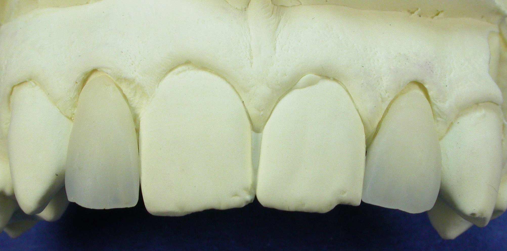 ceramica2