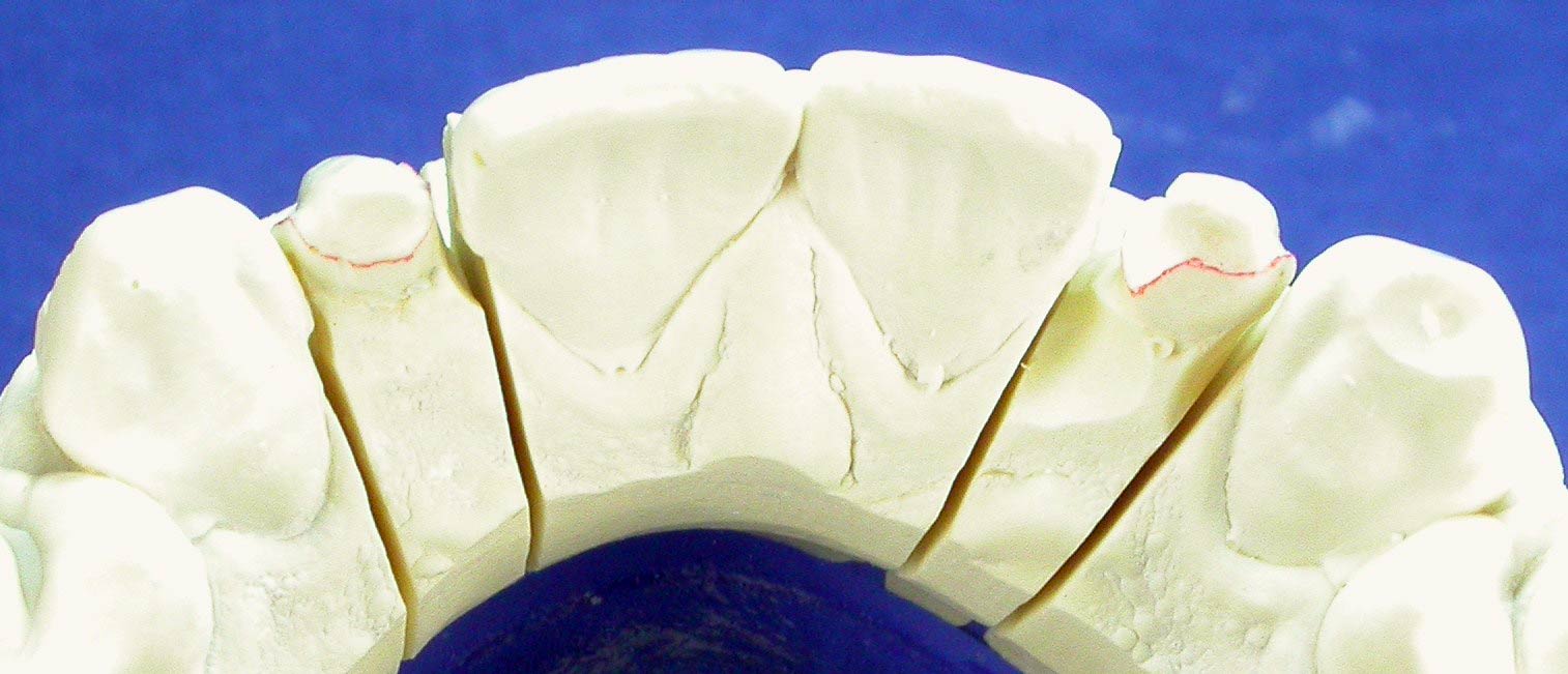ceramica3