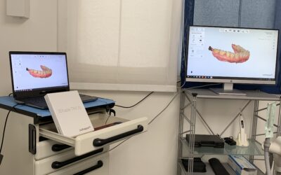 Scansione digitale intraorale